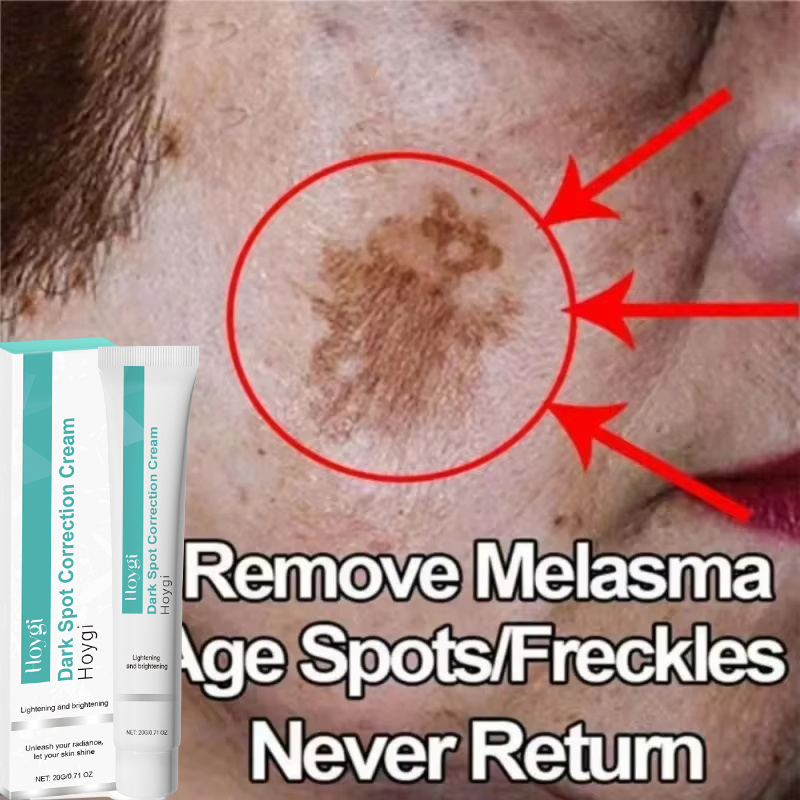 Powerful Spot-removing Whiten  - огляд і ціна Luxury Skincare Brands
