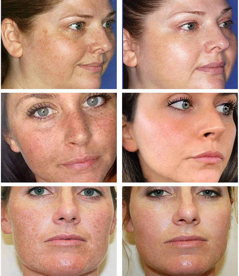 Powerful Spot-removing Whiten  - огляд і ціна Luxury Skincare Brands