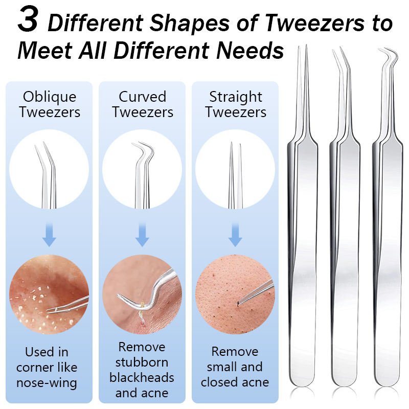 Stainless Steel Acne Blackhead - огляд і ціна Luxury Skincare Acne