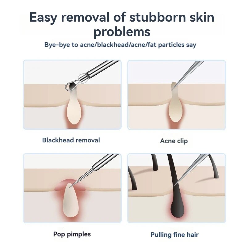 7pcs Stainless Steel Splinter  - огляд і ціна Luxury Skincare Acne